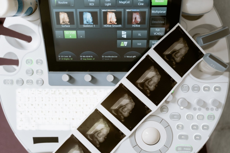 E(3)-Pose ile Fetal MRI Görüntülemesi Geliştiriliyor